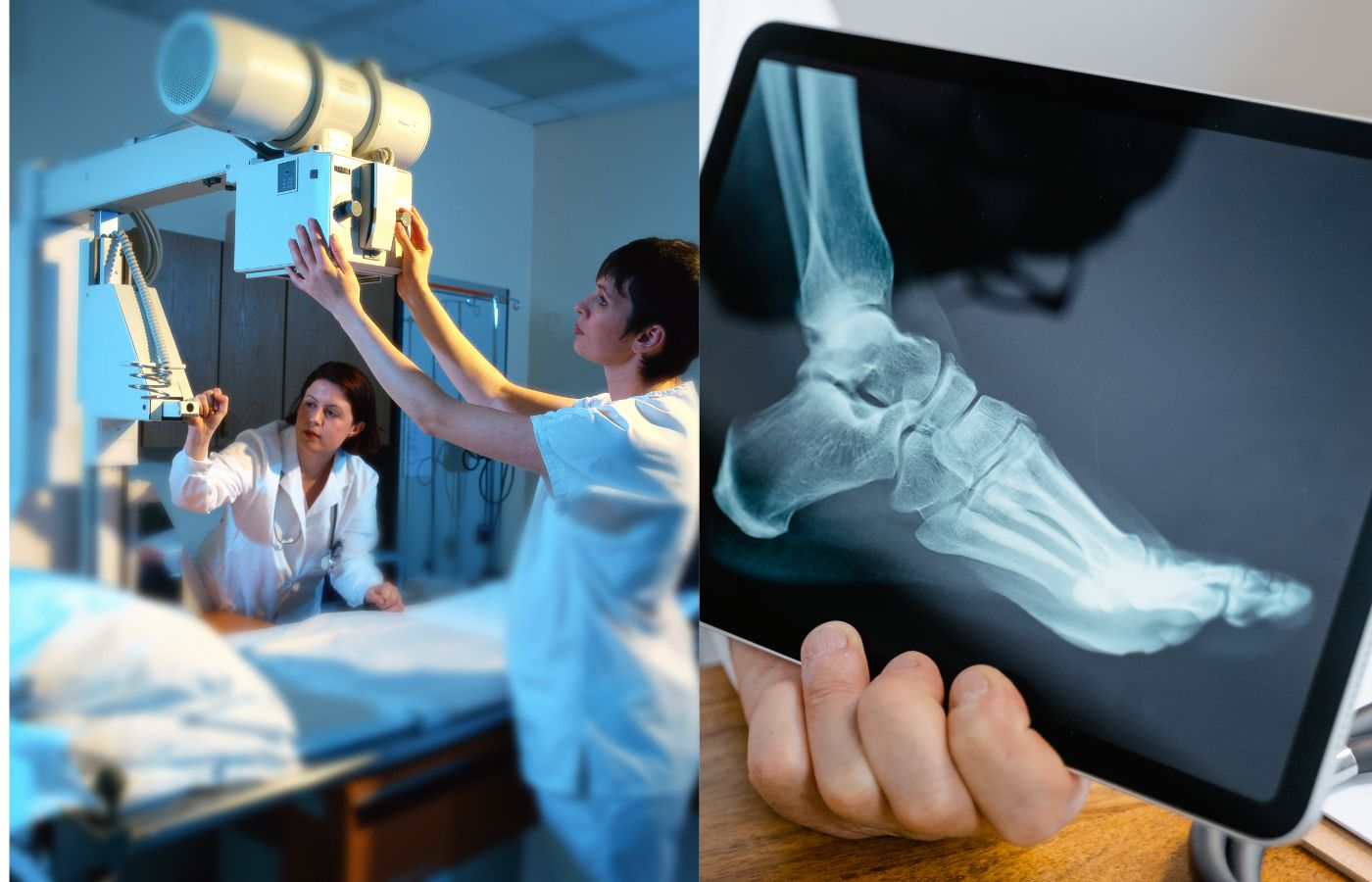 Abdomen Standing View X-Rays Near You